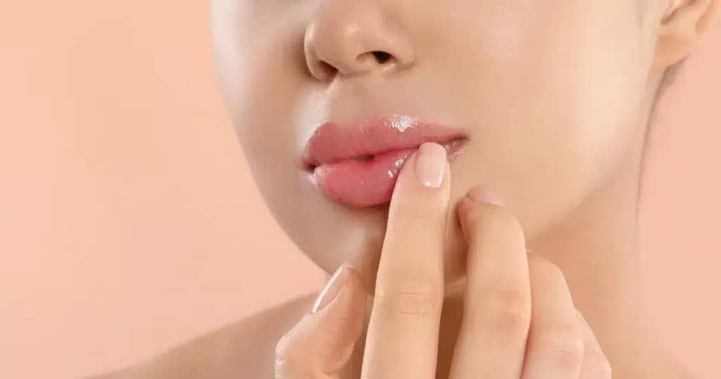 5 Benefits of Lip Fillers