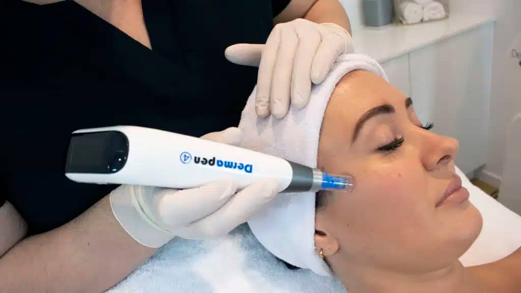 What's the Dermapen?