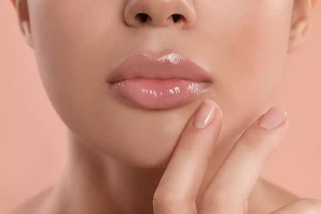 5 Benefits of Lip Fillers