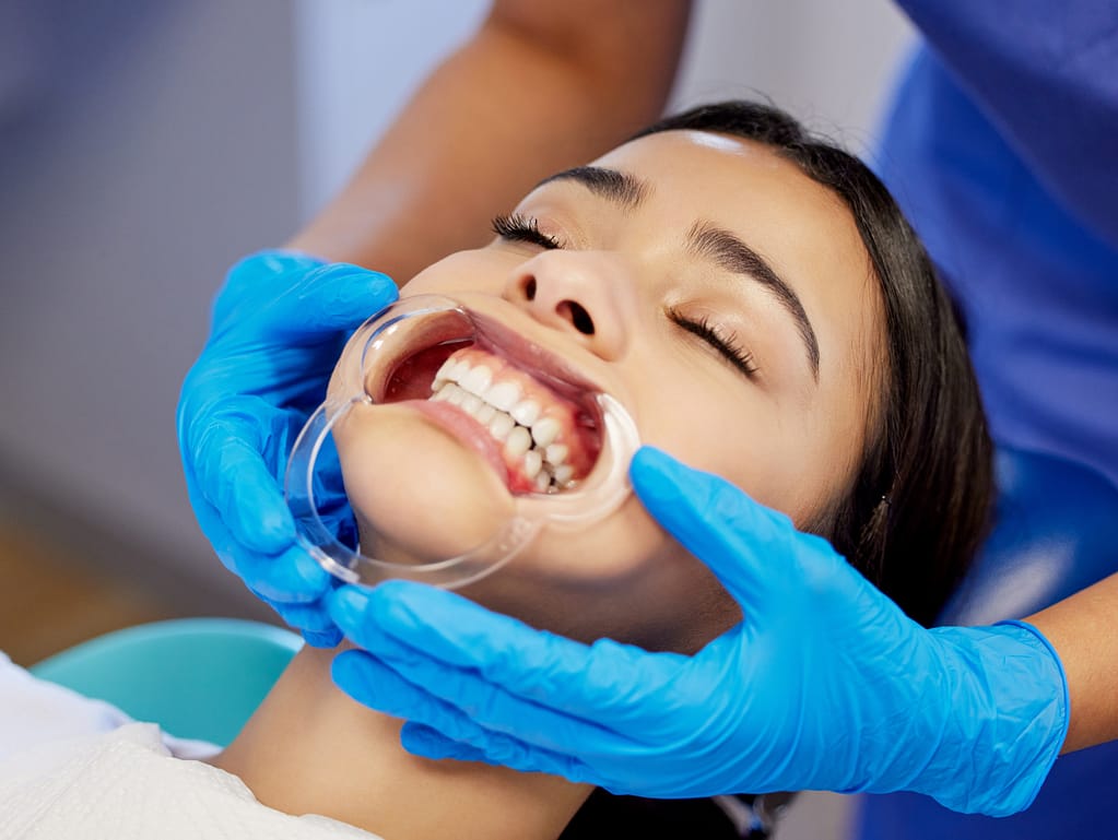 Orthodontics Benefits