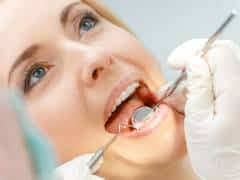 Best veneers in Dubai