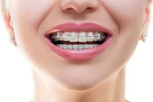 Orthodontics