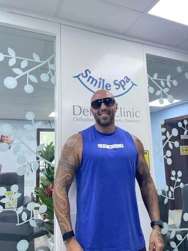 Best veneers in Dubai