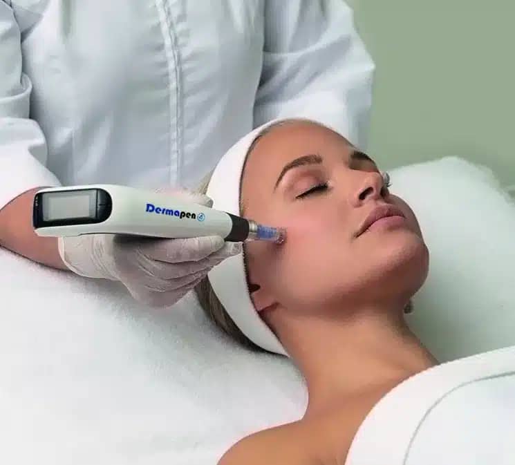 What's the Dermapen?