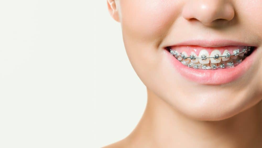 orthodontics