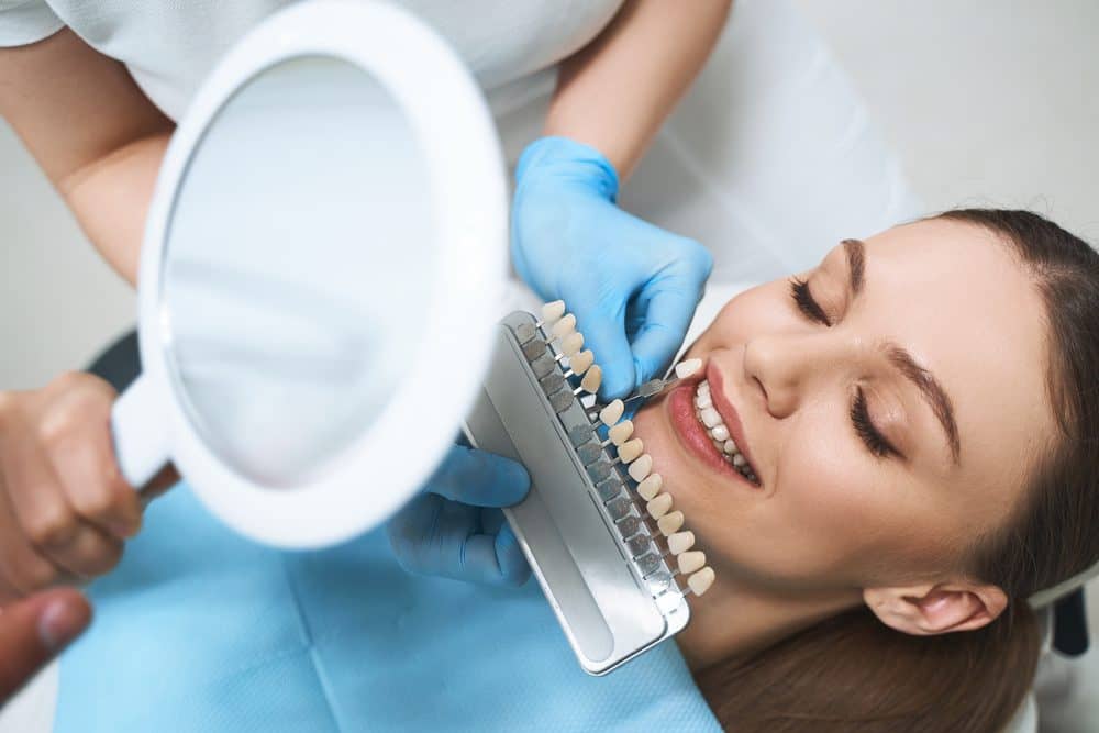 Emax Veneers
