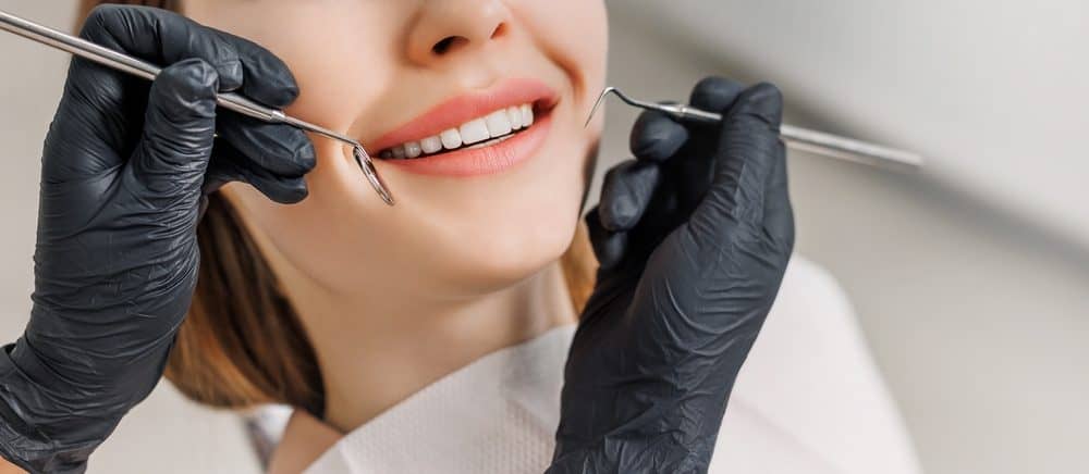Emax Veneers