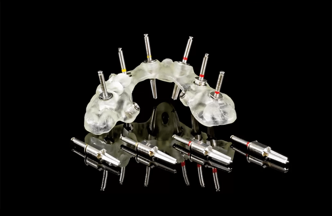 3D Guided Implant Surgery